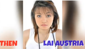 Lai Austria Old Photos Before Supposed Surgery Resurface? Netizens