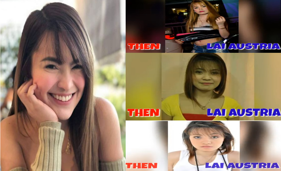 Lai Austria Old Photos Before Supposed Surgery Resurface? Netizens ...